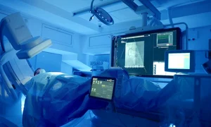 1 angiograf coronarografie clicksanatate jpg jpeg