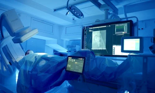 1 angiograf coronarografie clicksanatate jpg jpeg