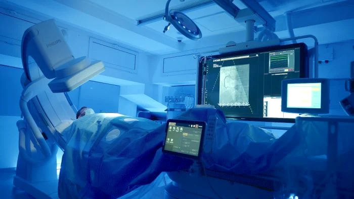 1 angiograf coronarografie clicksanatate jpg jpeg