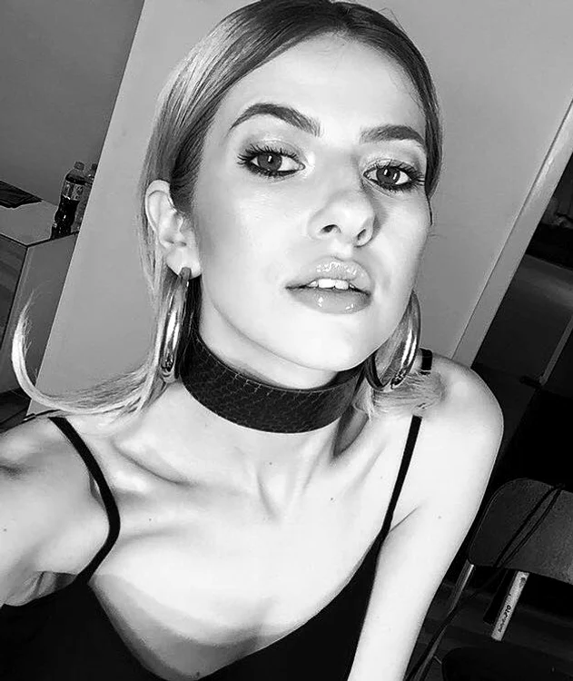 Lidia Buble anorexica jpeg