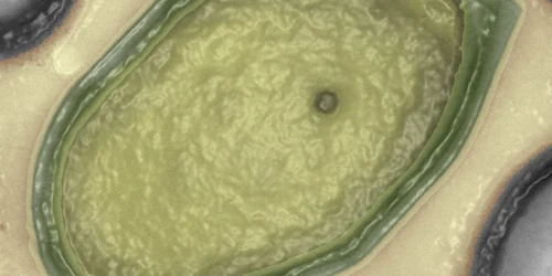 pandovirus foto NPR.com