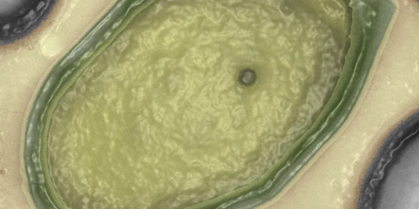 pandovirus foto NPR.com
