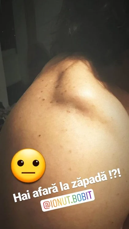 Pepe s-a accidentat pe pârtie