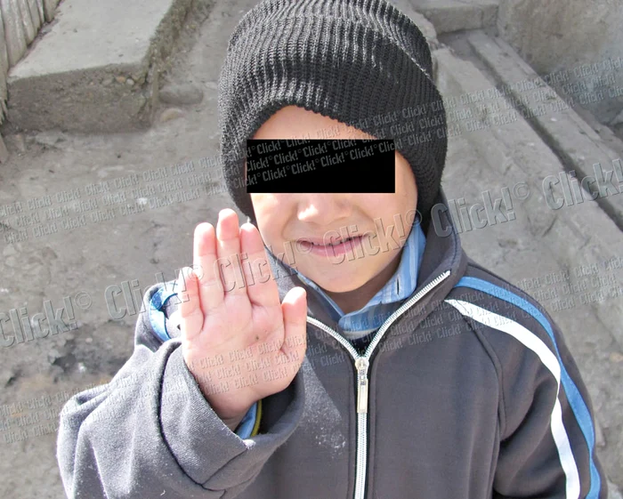 Alexandru ne-a arătat palmele arse