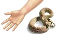 muscatura de sarpe veninos jpeg