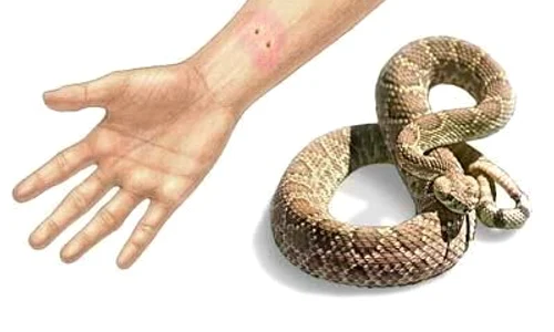 muscatura de sarpe veninos jpeg