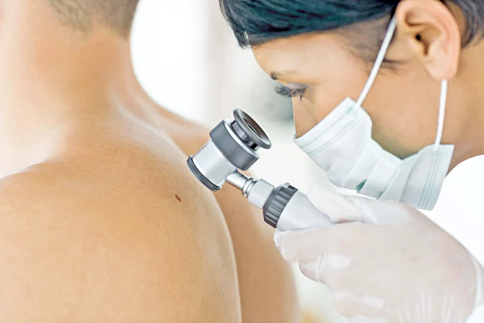 Specialiştii îţi recomandă să mergi la control dacă observi cea mai mică modificare a formei şi a culorii lor