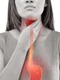 reflux gastroesofagian 1 jpeg