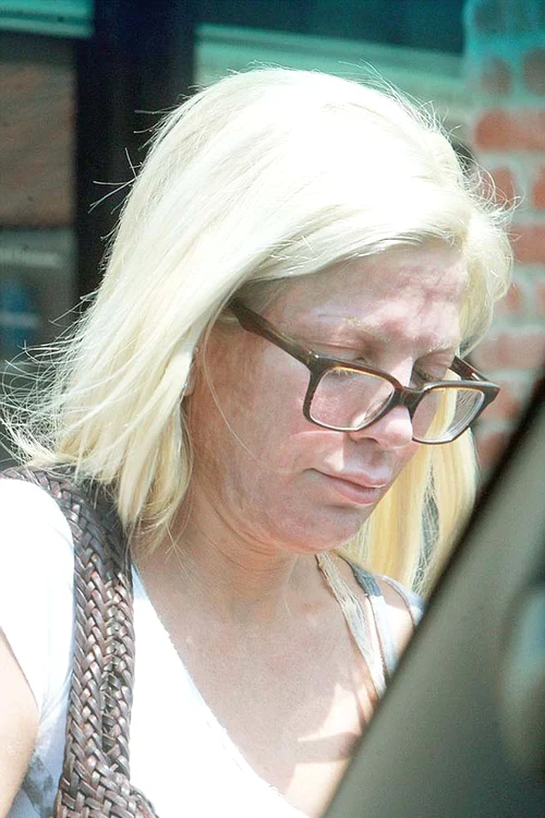 
    2015. Iese de la centrul medical cu faţa făcută prafFoto: Guliver/Getty Images/Photoland / Wenn  