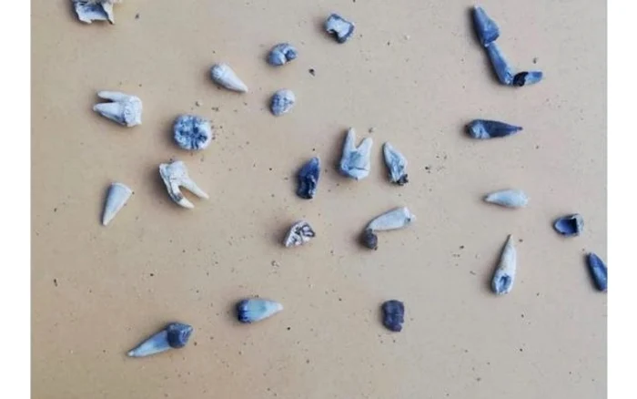 Un cunoscut medic stomatolog din Buzău a analizat fotografia în care apar dinţii găsiţi în butoiul unde se crede că suspectul Gheorghe Dincă ar fi incinerat rămăşiţe umane