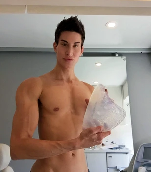 2 justin jedlica operatii estetice 2 jpg jpeg