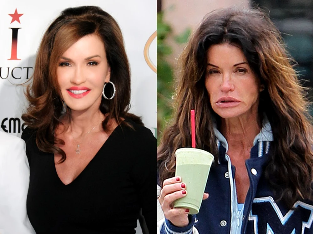 Janice Dickinson