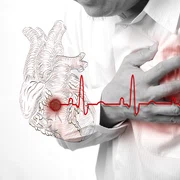 infarct stop cardiac inima jpeg