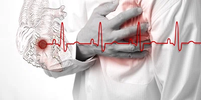 infarct stop cardiac inima jpeg