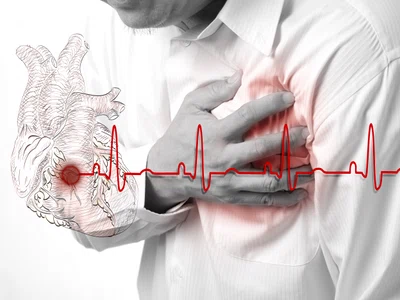 infarct stop cardiac inima jpeg