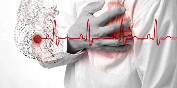 infarct stop cardiac inima jpeg