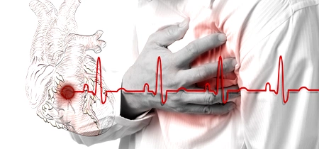 infarct stop cardiac inima jpeg