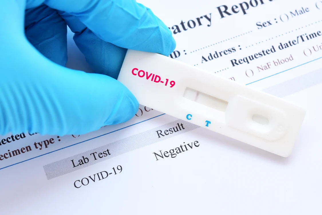 
    Când mergi să îți faci testul, trebuie să specifici dacă ai avut COVID sau ai fost vaccinatFoto: Shutterstock  