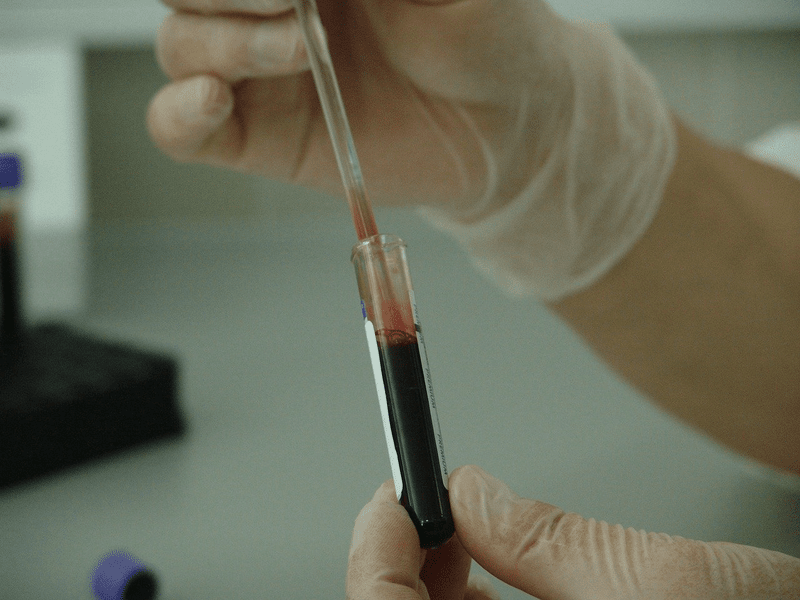 Sistemul imunitar poate fi învățat să atace tumorile canceroase. Studiul care a descoperit potențialul pentru un nou tratament