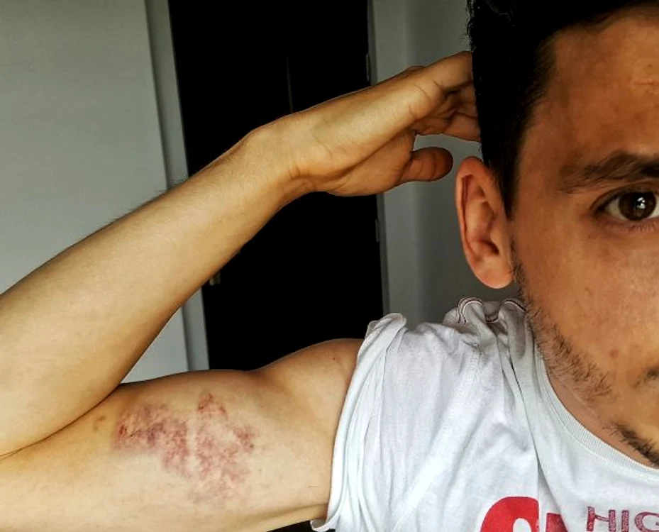 
    Un tânăr bucureștean îi acuză pe controlorii RATB că l-au lovit Foto: arhivă personală  