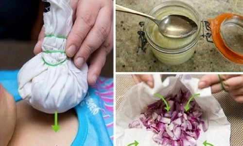 1 remedii cu ceapa jpg jpeg