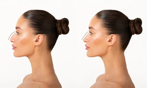 shutterstock 2466127937 jpg