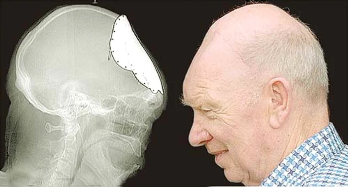 Elvis Romeo Lingurar