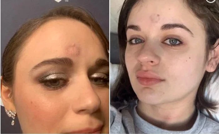 1 joey deschidere jpg jpeg