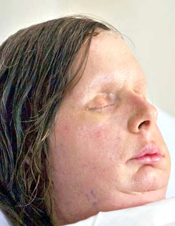 Americanca Charla Nash după tragedie (Fotografii: Reuters)