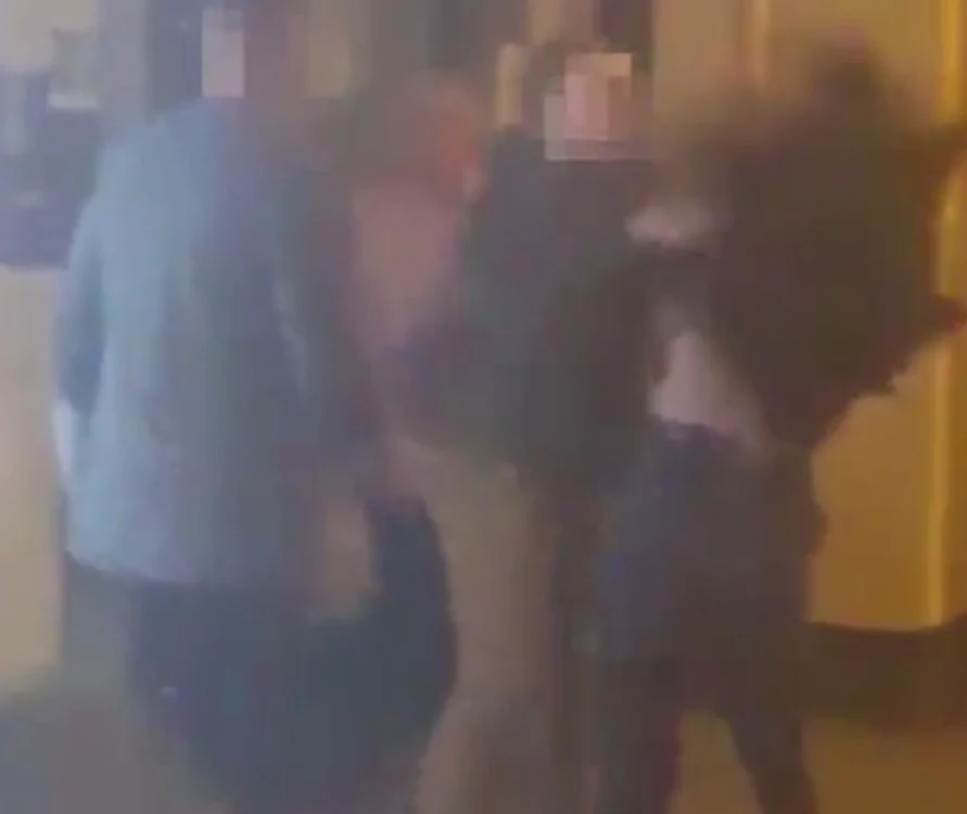 Tânăra s-a ales cu fracturi severe și va fi operată