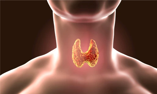 1 83059 original jpg jpeg