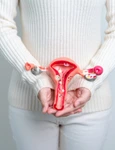 Fibrom uterin jpg