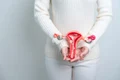 Fibrom uterin jpg