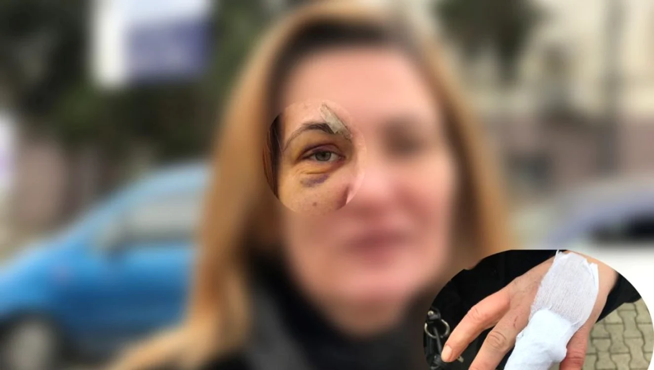 
    Asistenta de la Iaşi, bătută de iubitfoto: BZI.ro  