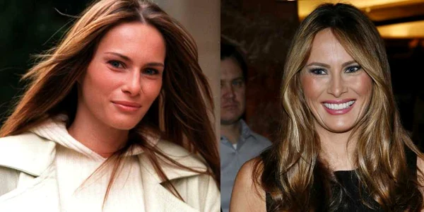 melania