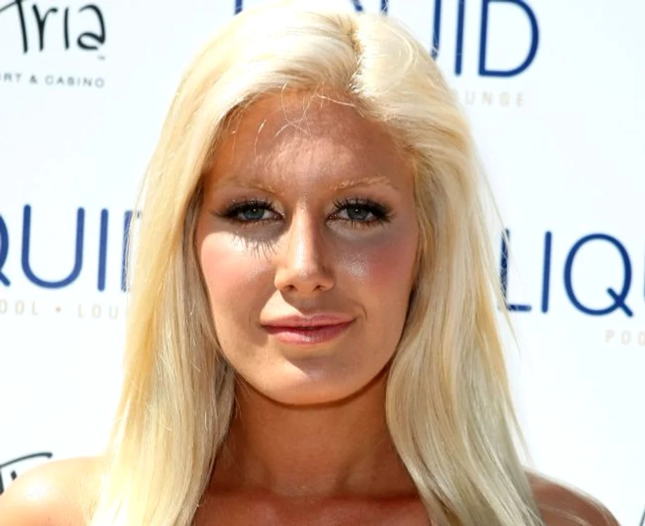 
    Heidi Montag este o fană declarată a operaţiilor estetice. (sursa foto: celebitchy.com)  
