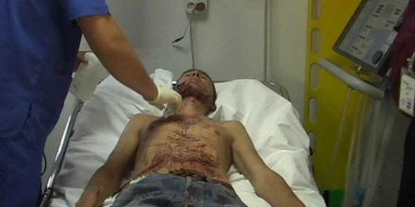Pacientul de 20 de ani agresiv de la Iaşi 