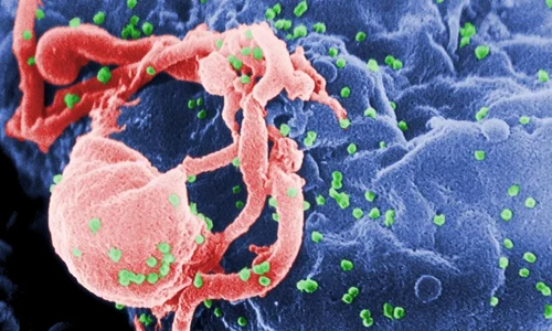 Strămoşul virusului HIV, mult mai vechi decât se credea jpeg