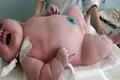 Cel mai mare bebeluș din toate timpurile a cântărit 16 kilograme la naştere  jpeg