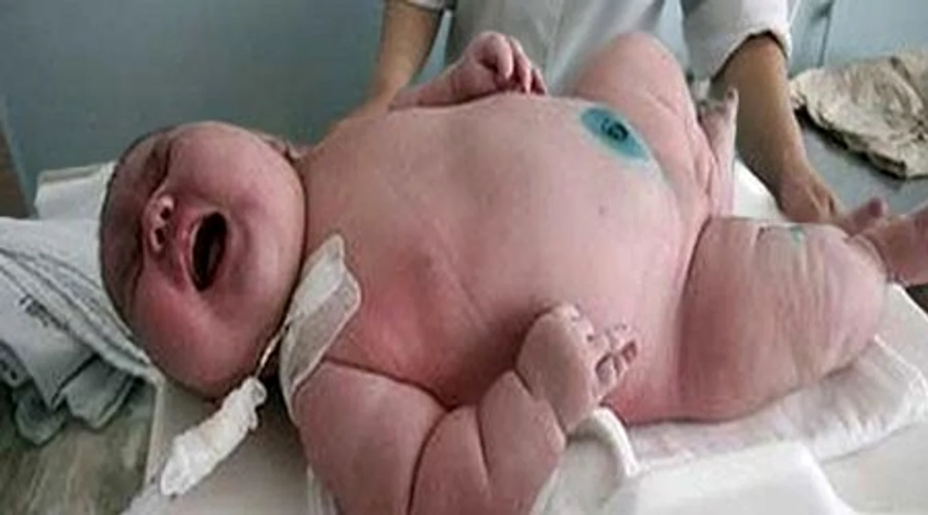 Cel mai mare bebeluș din toate timpurile cântărește 16 kilograme