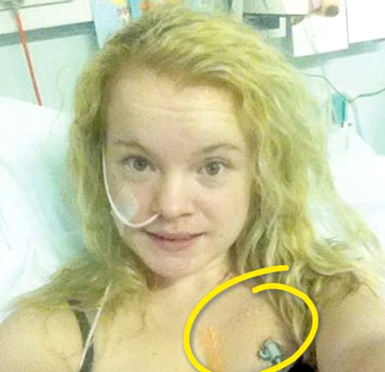 
    Ayllah (19 ani) nu a  mâncat hrană  solidă de 5 ani  