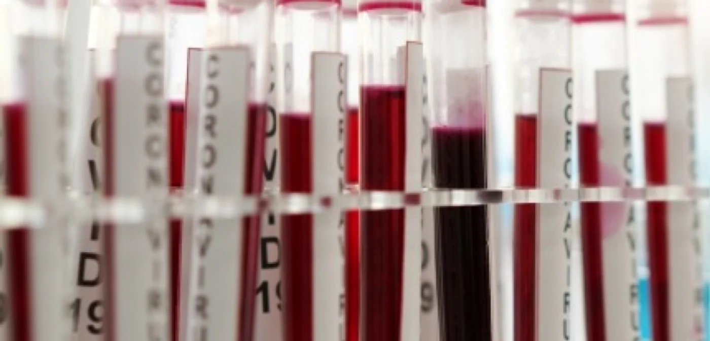 Noi concluzii ale unui Studiu MedLife în parteneriat cu Institutul Naţional de Boli Infecţioase Prof. Dr. Matei Balş şi Spitalul Clinic Colentina din Bucureşti FOTO: Synevo.ro