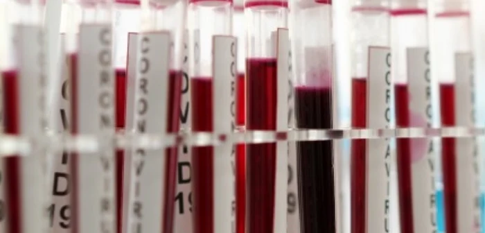 Noi concluzii ale unui Studiu MedLife în parteneriat cu Institutul Naţional de Boli Infecţioase Prof. Dr. Matei Balş şi Spitalul Clinic Colentina din Bucureşti FOTO: Synevo.ro
