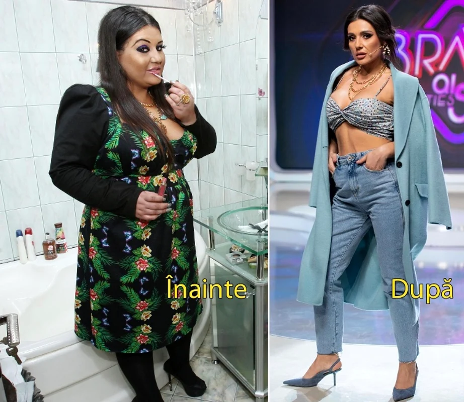 Bia Rus a pierdut 70 de kilograme după gastric sleeve Foto: Click!