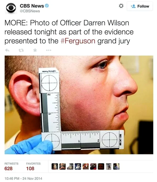 După incident, poliţistul Darren Wilson s-a prezentat la medic unde acesta prezenta răni la nivelul feţei