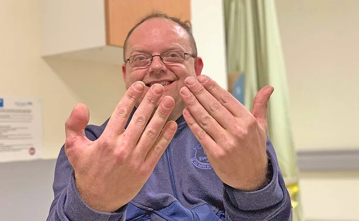 David Lee, 40 de ani, a terminat toate comenzile folosind degetul cel nouFoto: profimedia