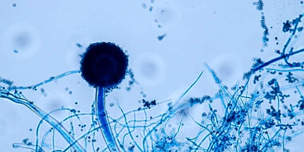 aspergillus niger oryze mold under 600nw 2143168791 webp