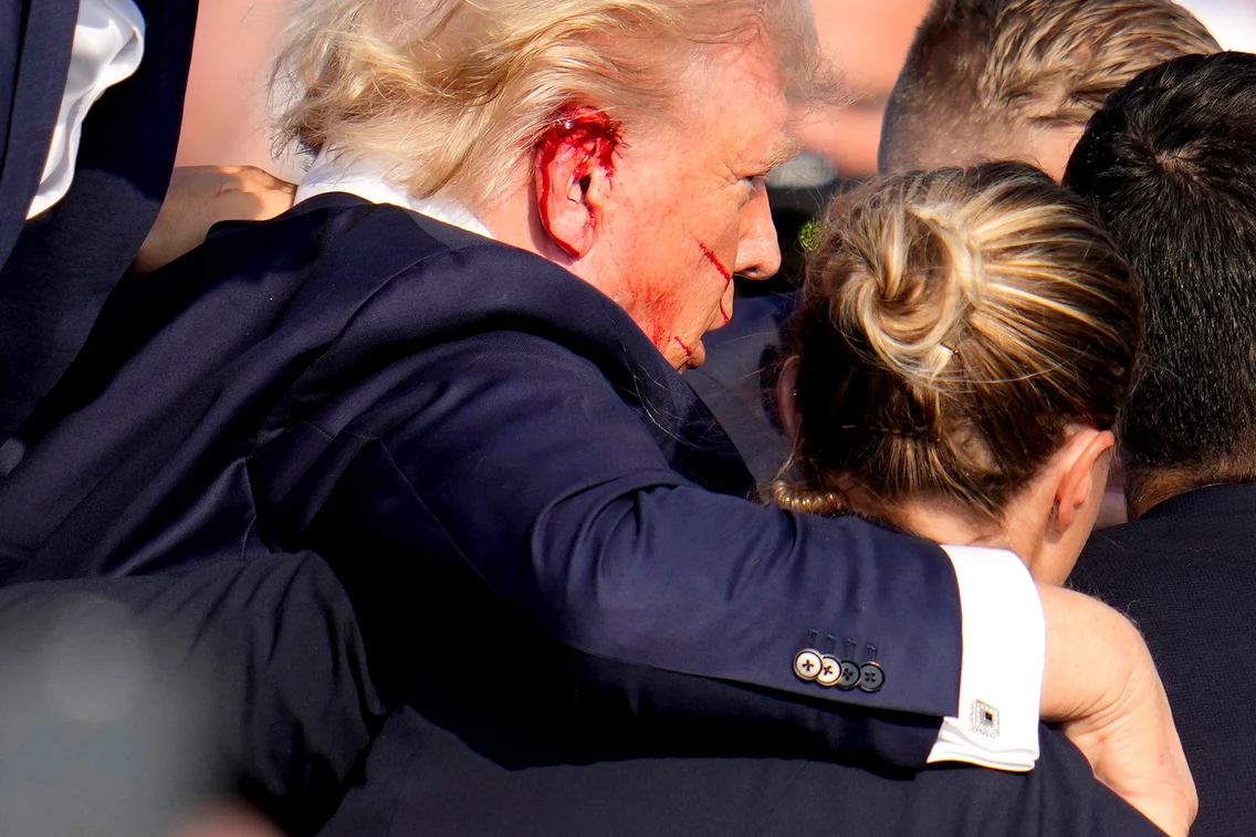 Donald Trump rănit  foto   Profimedia
