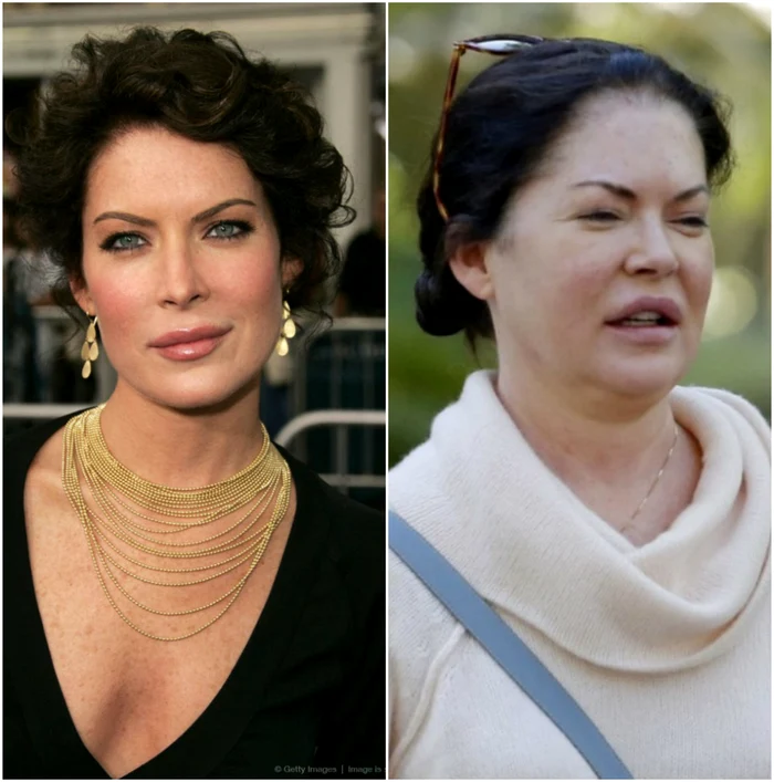 4 lara flynn boyle before after 1170x1182 jpg jpeg