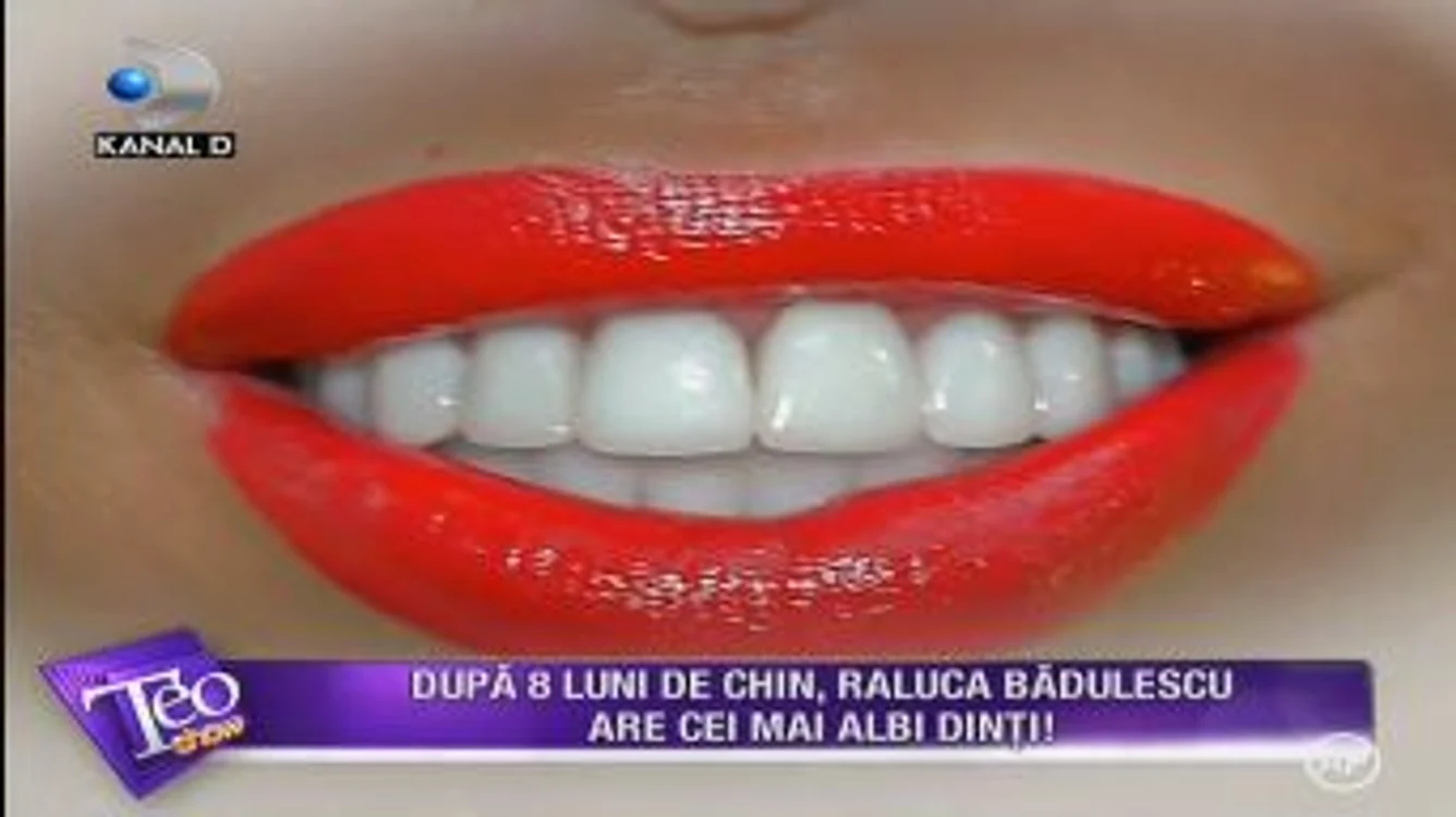 Raluca Bădulescu a investit mult timp și mulți bani pentru noul ei zâmbet